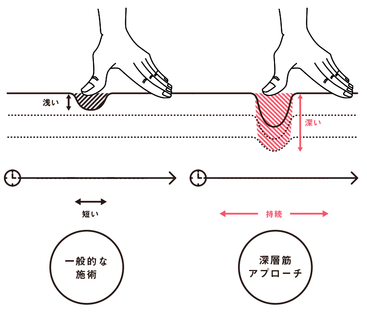 深層筋アプローチ